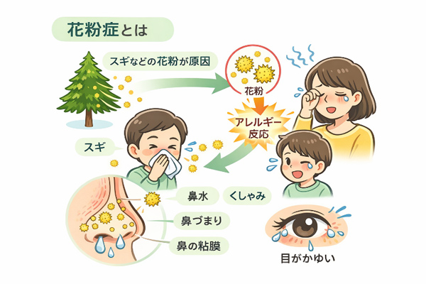 花粉症とは